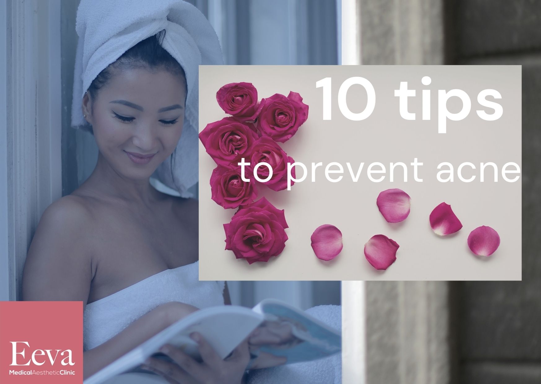 acne prevention tips