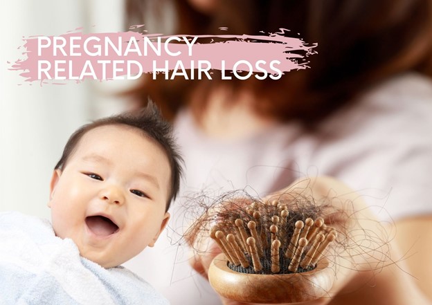 Hair Loss in Pregnancy