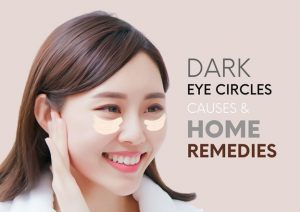dark eye circle causes and remedy