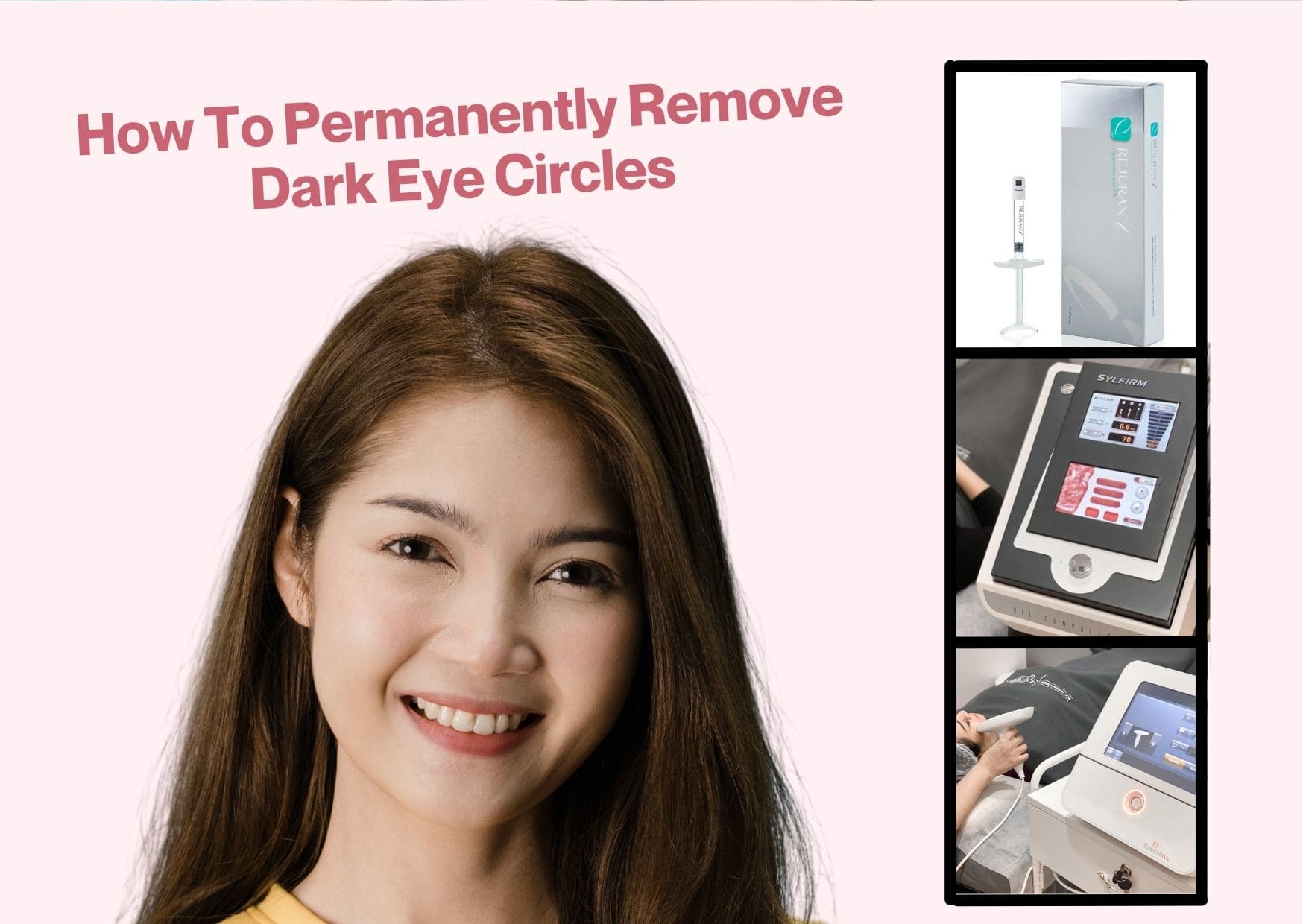 Dark eye circles: How to remove them permanently