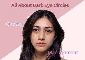 Dark Eye Circle Singapore